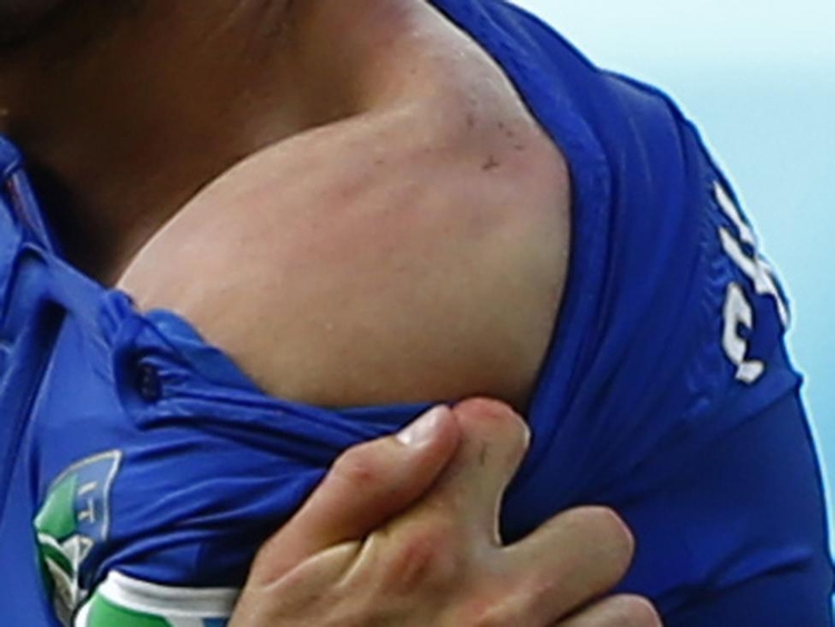 fot. Tony Gentile / Reuters / 24 czerwca 2014  Natal, Brazylia  Giorgio Chiellini pokazuje ślad po ugryzieniu przez Luisa Suareza. Urugwajczyk dopuścił się tego osławionego czynu w trakcie jednego z meczów Mistrzostw Świata w Piłce Nożnej.
